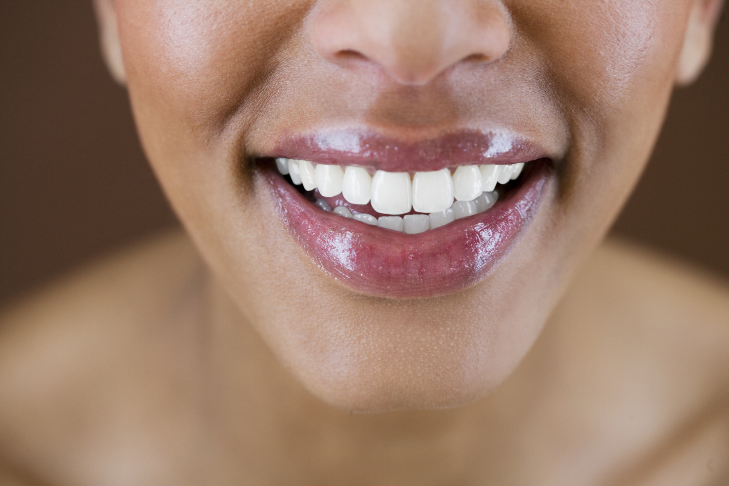 Cómo mantener los dientes blancos después del blanqueamiento