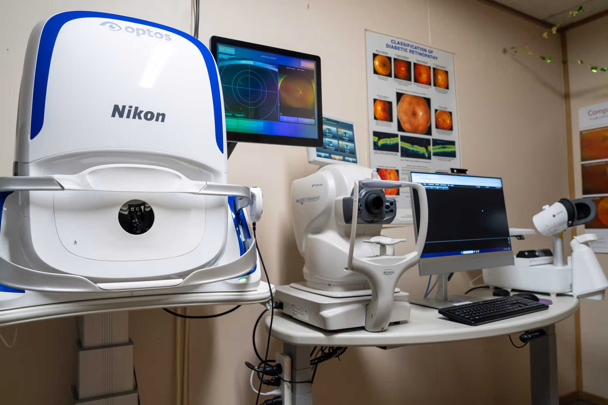 Optos Retinal Imaging machine
