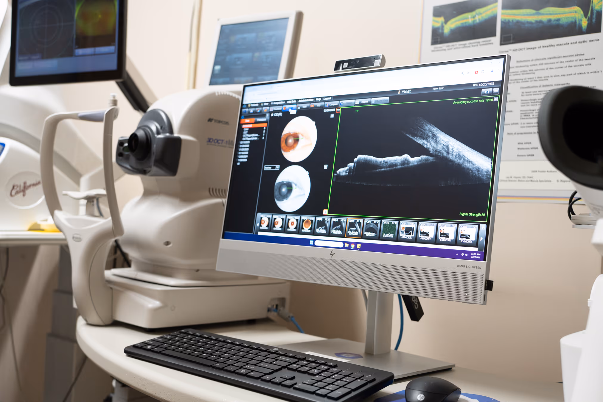 Topcon machine and graph on computer screen