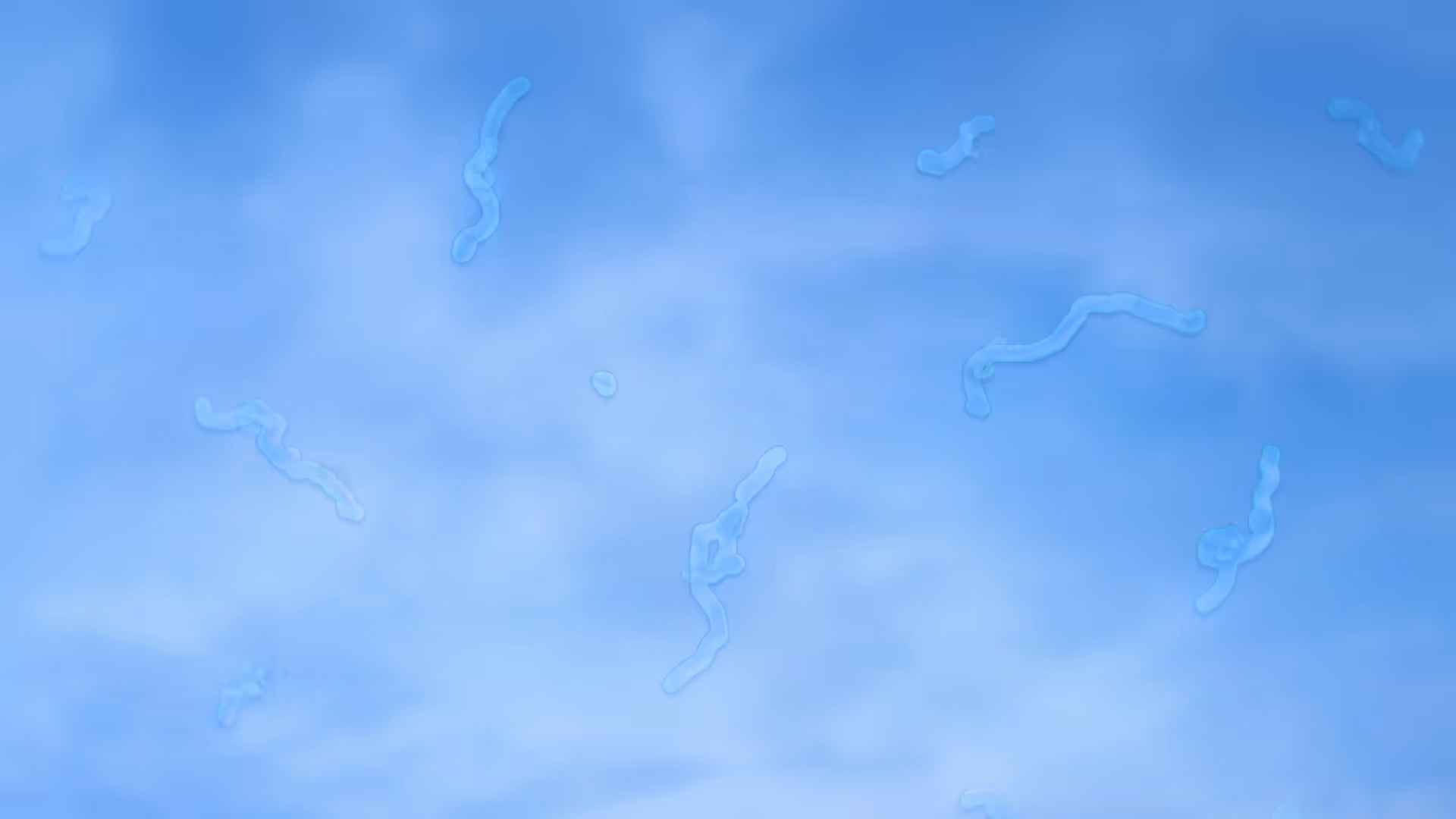 Vitreous floaters visualization