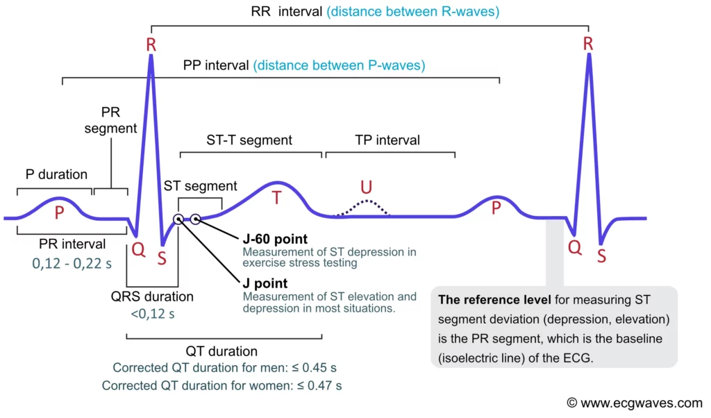 ECG interpretation: Characteristics of the normal ECG (P-wave ...