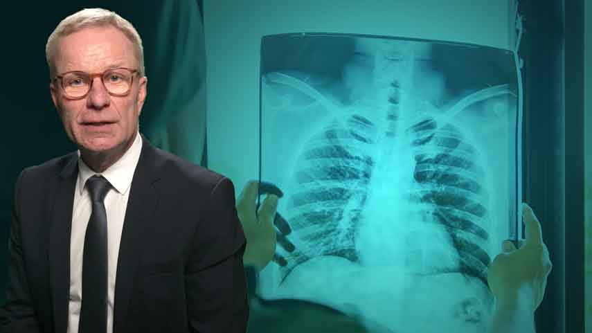 Tuberkulose – die alte und neue Seuche