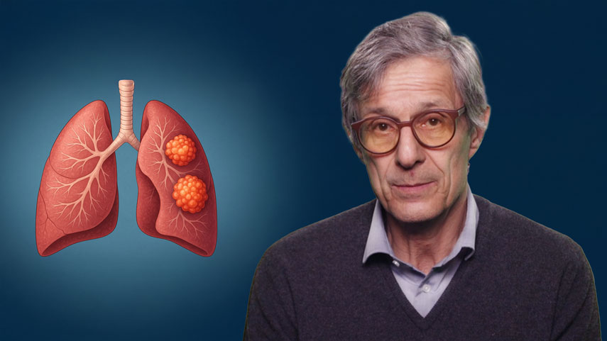 Immuntherapie bei NSCLC - nicht metastasierte Stadien (adjuvante + neoadjuvante Therapien)