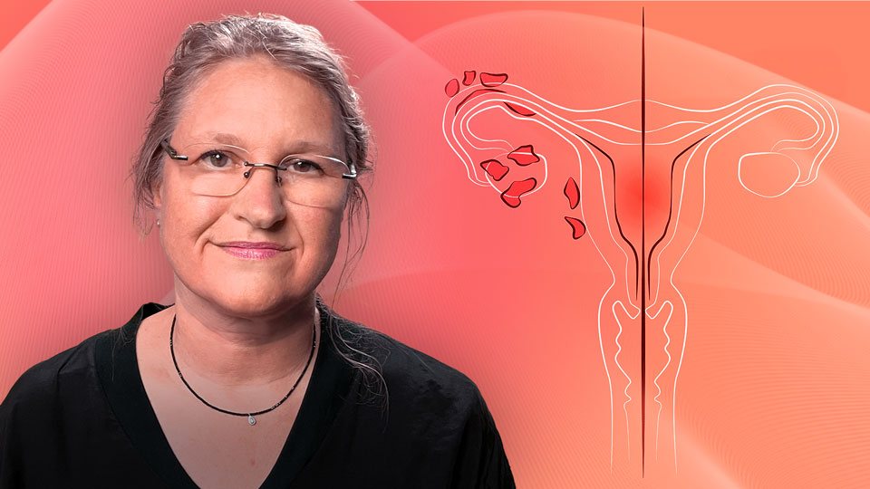 Diagnostik und Therapie der Endometriose