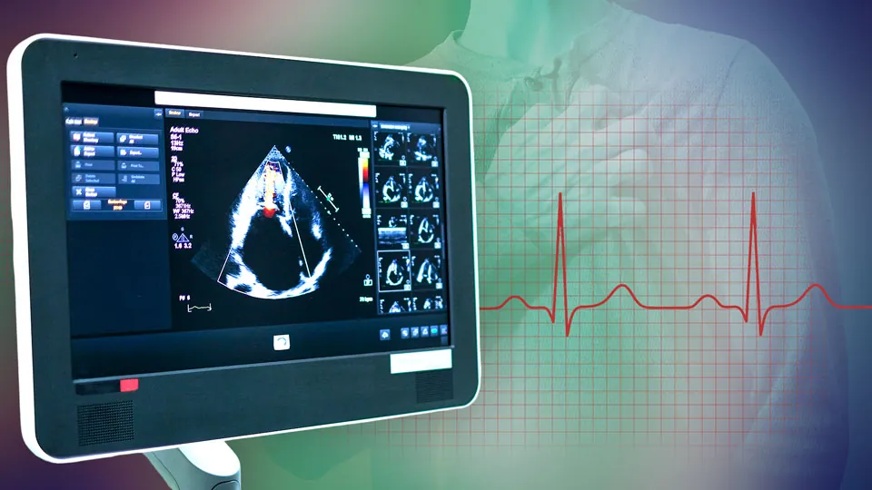 Interaktive Fallvorstellung: HOCM (Hypertrophe obstruktive Kardiomyopathie)