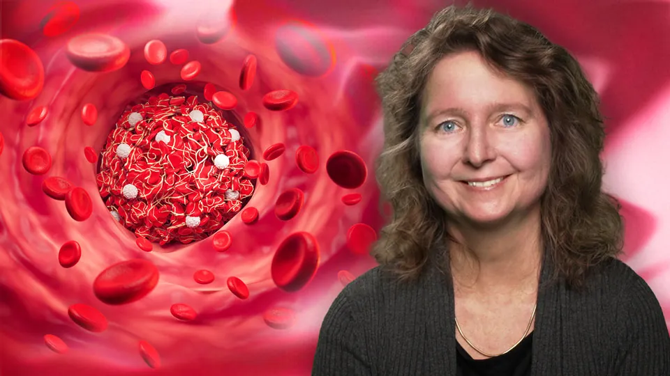 Konservative Therapie der PAVK: Update S3-Leitlinie PAVK