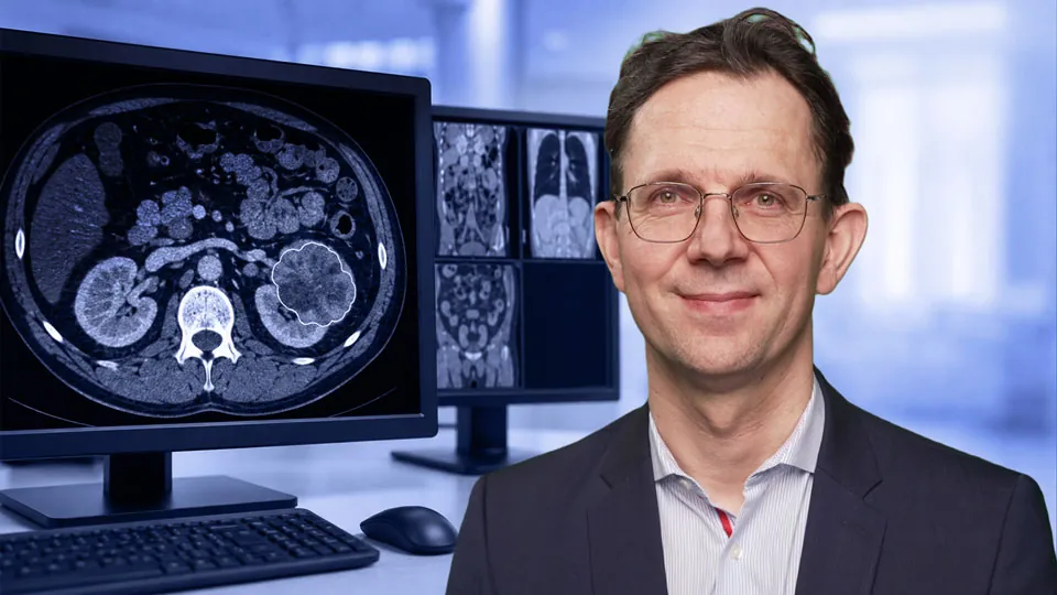 Systemtherapie beim Nierenzellkarzinom - State of the Art