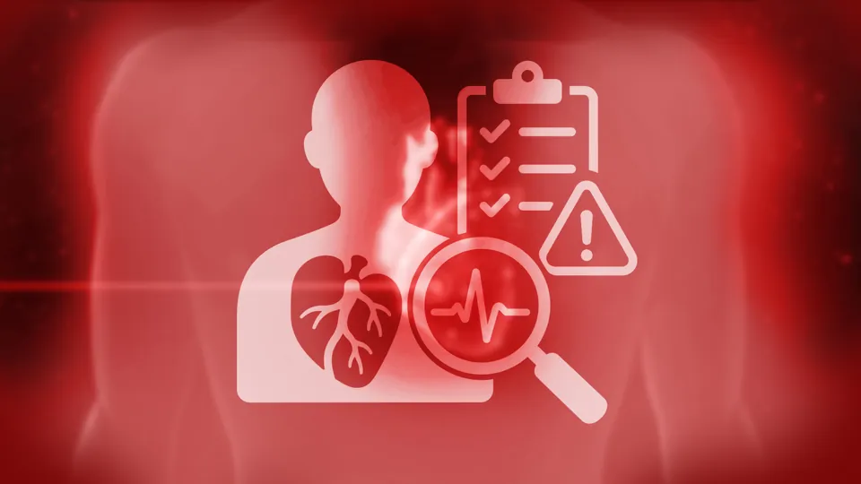 Chronisches Koronarsyndrom: KHK-Risikopatienten effizient identifizieren