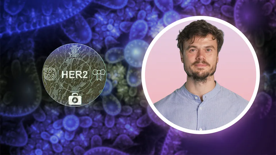 HER2-Diagnostik – Nachweismethoden im Vergleich