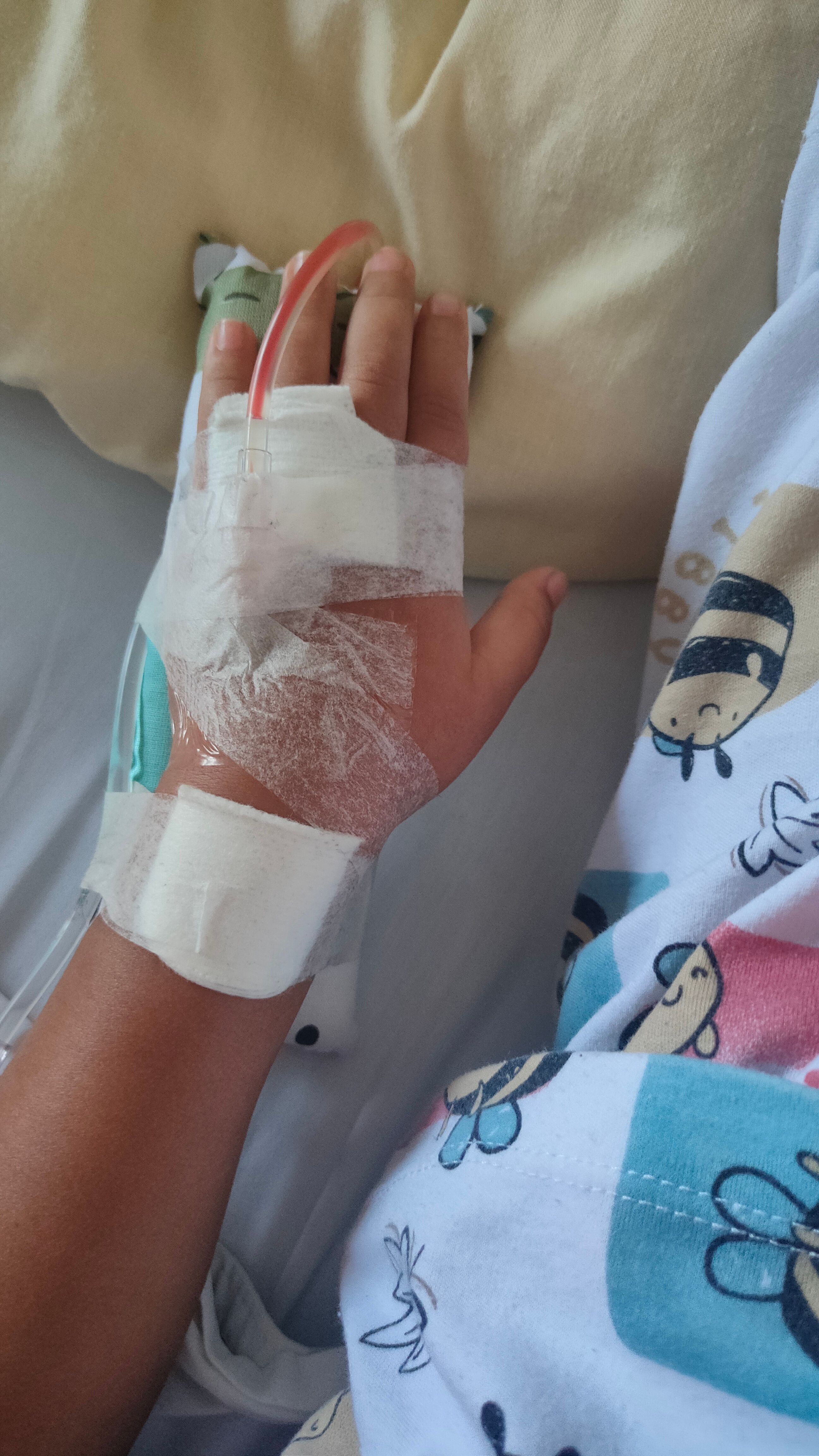 Close-up of a hand with an IV line and bandage in a hospital setting