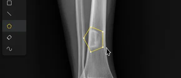 feature-image
