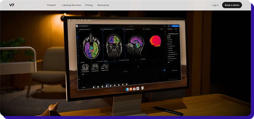 v7 DICOM annotation image