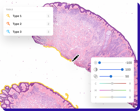 labelbox DICOM annotation image