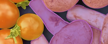 Semantic Segmentation