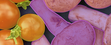 Semantic Segmentation