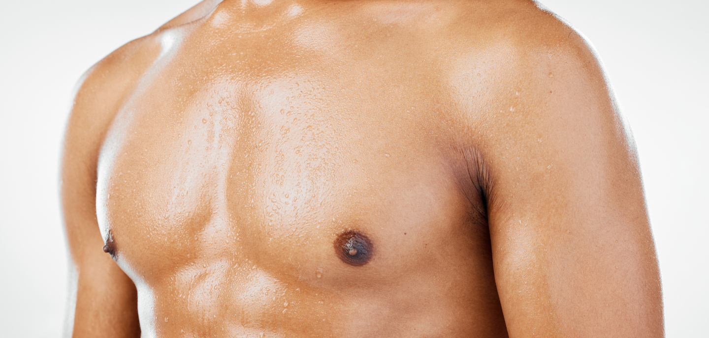 Gynäkomastie (Männerbrust)