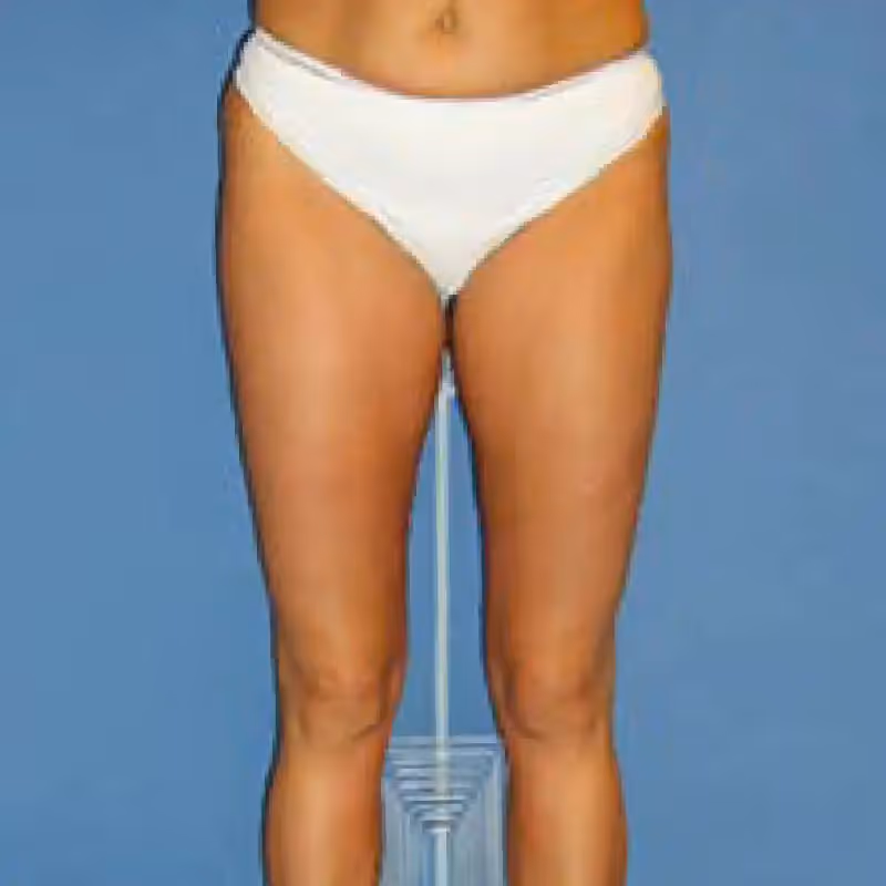 STORZ MEDICAL 2