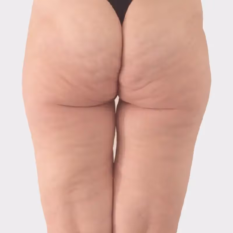 DEKA ONDA 1