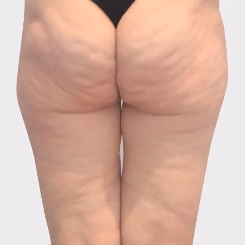 DEKA ONDA 1