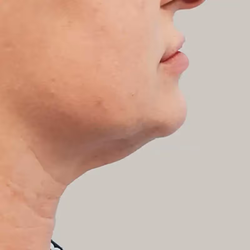 DEKA ONDA 7 man