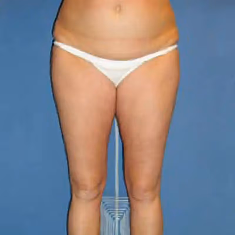 STORZ MEDICAL 2