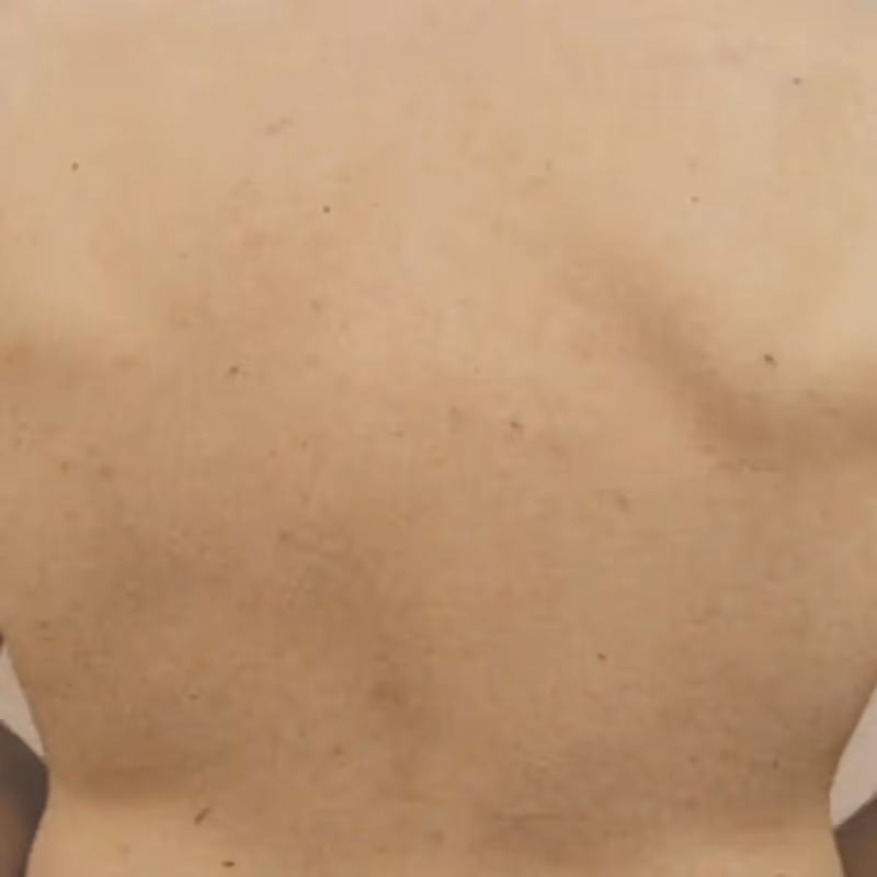 COCOON MEDICAL PRIMELASE 6 man