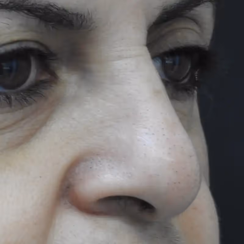 DERMACLEAR ALMA 3