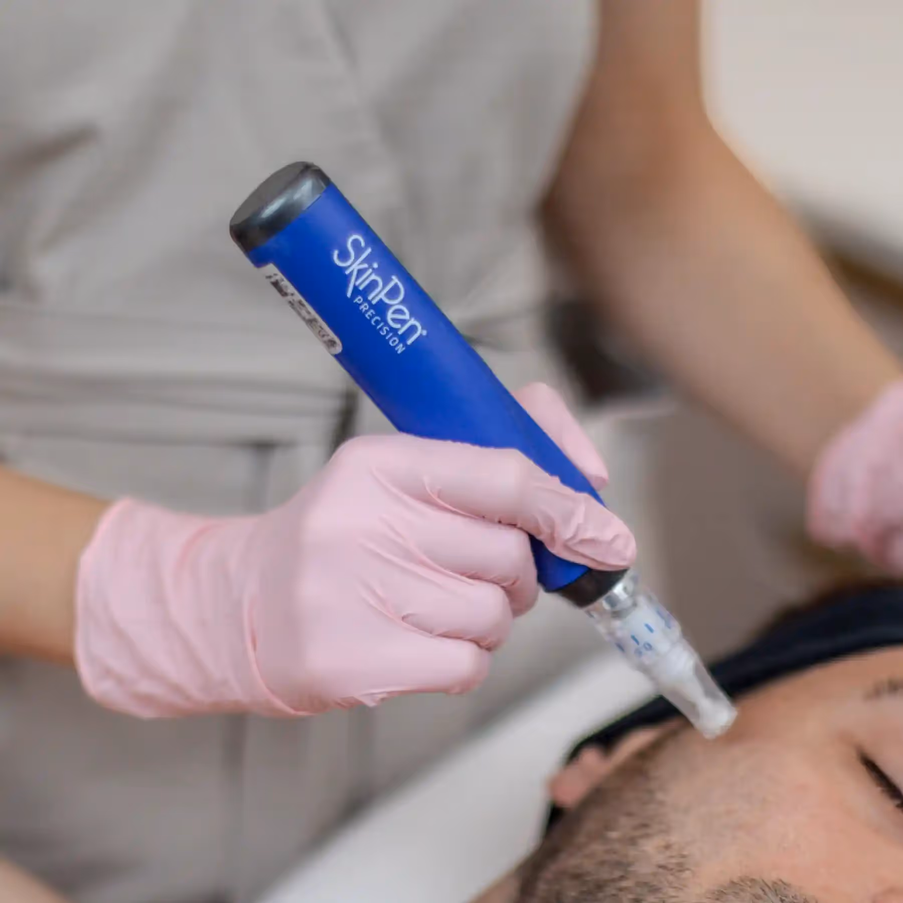 Jak przebiega zabieg SkinPen?