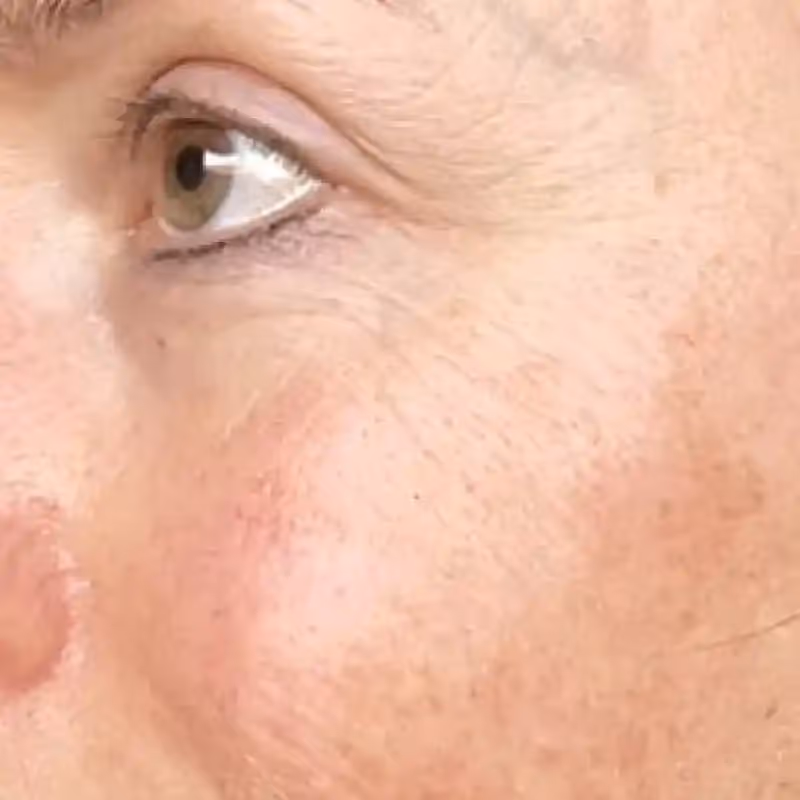 EGZOSOMY ASCEplus 2
