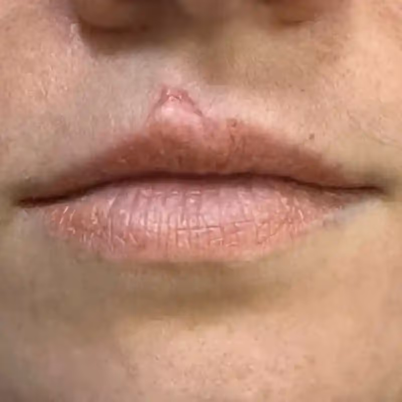 EGZOSOMY ASCEplus 3
