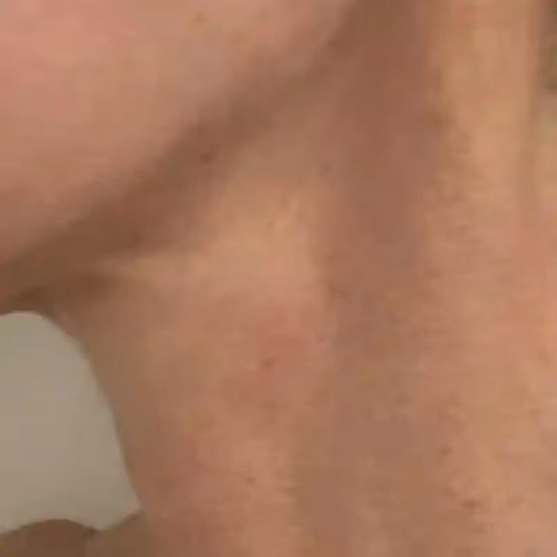 EGZOSOMY ASCEplus 5