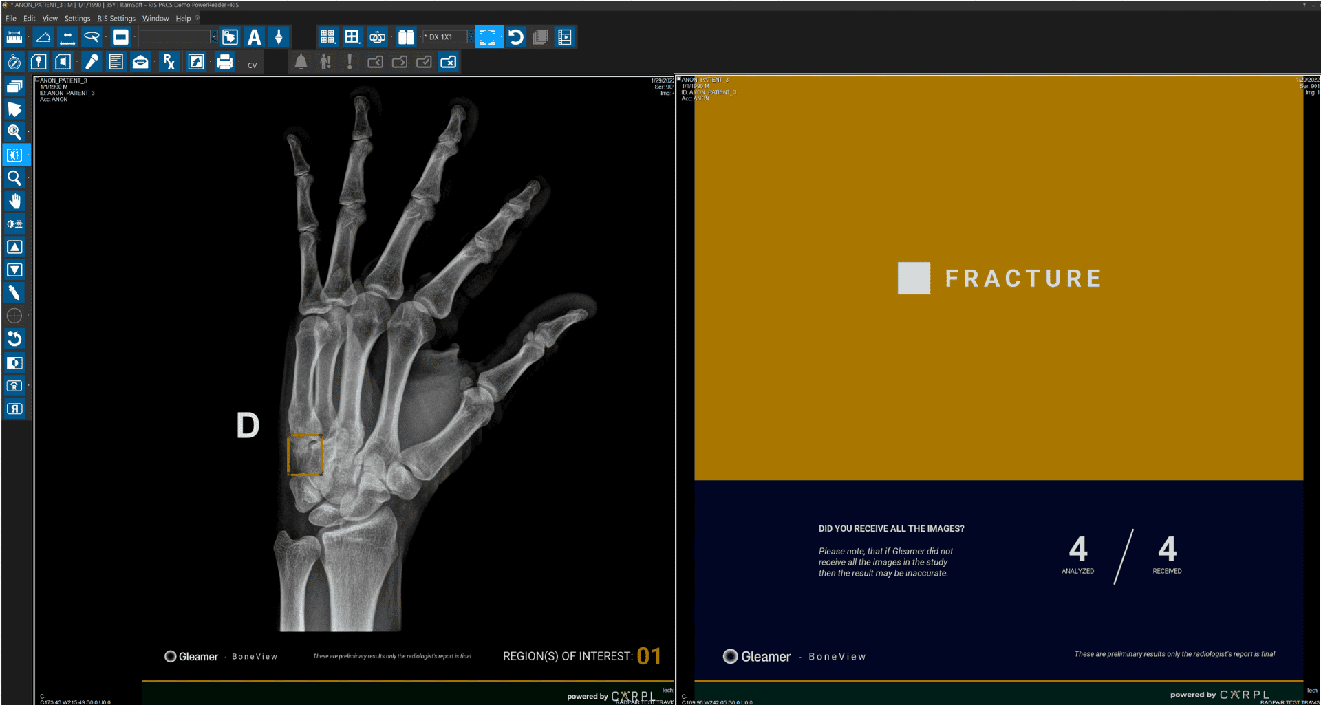 PACS and AI integration automated image analysis screenshot