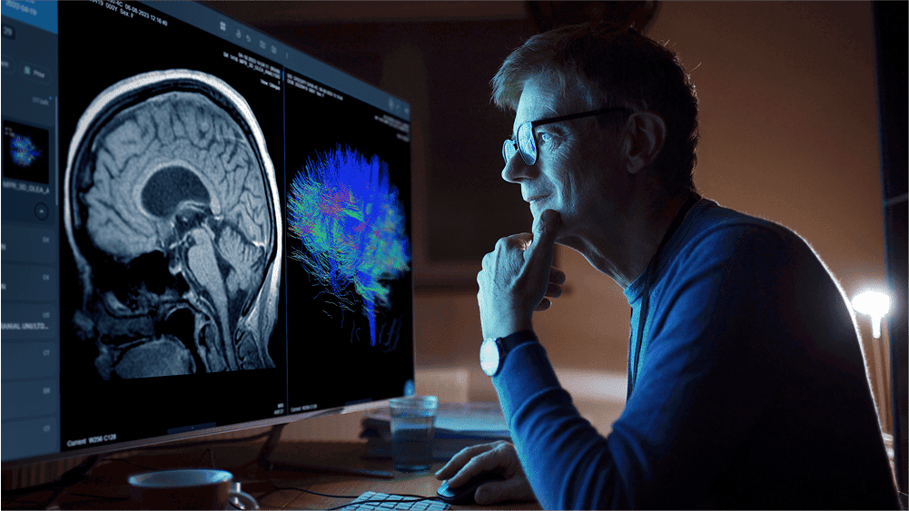 Radiologist viewing brain MRI with DTI on PACS system