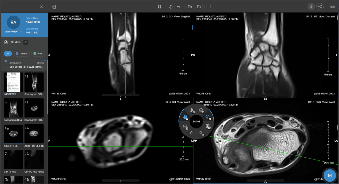 Radiologist interpreting images in PACS and creating structured reports for the workflow.