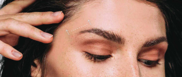 The area on a woman's face where she gets the fox eye brow lift