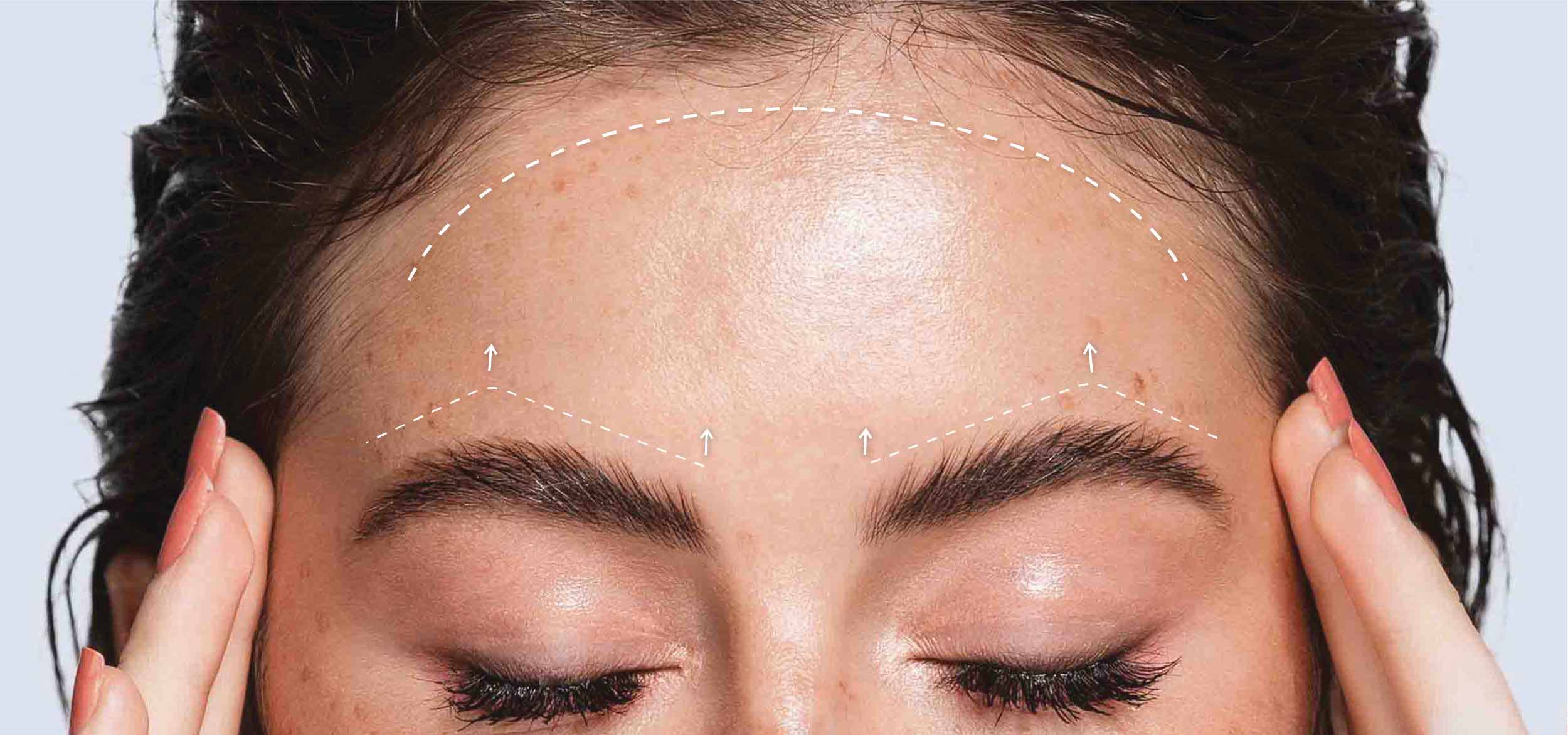 The area of a woman's forehead and how the brows would be lifted