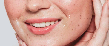 The laugh lines on a woman's face