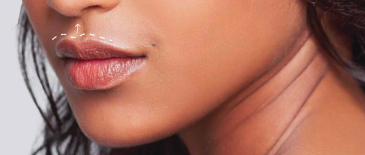 How a lip flip would look like on a woman's face