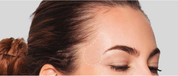 The temples areas on a woman's head