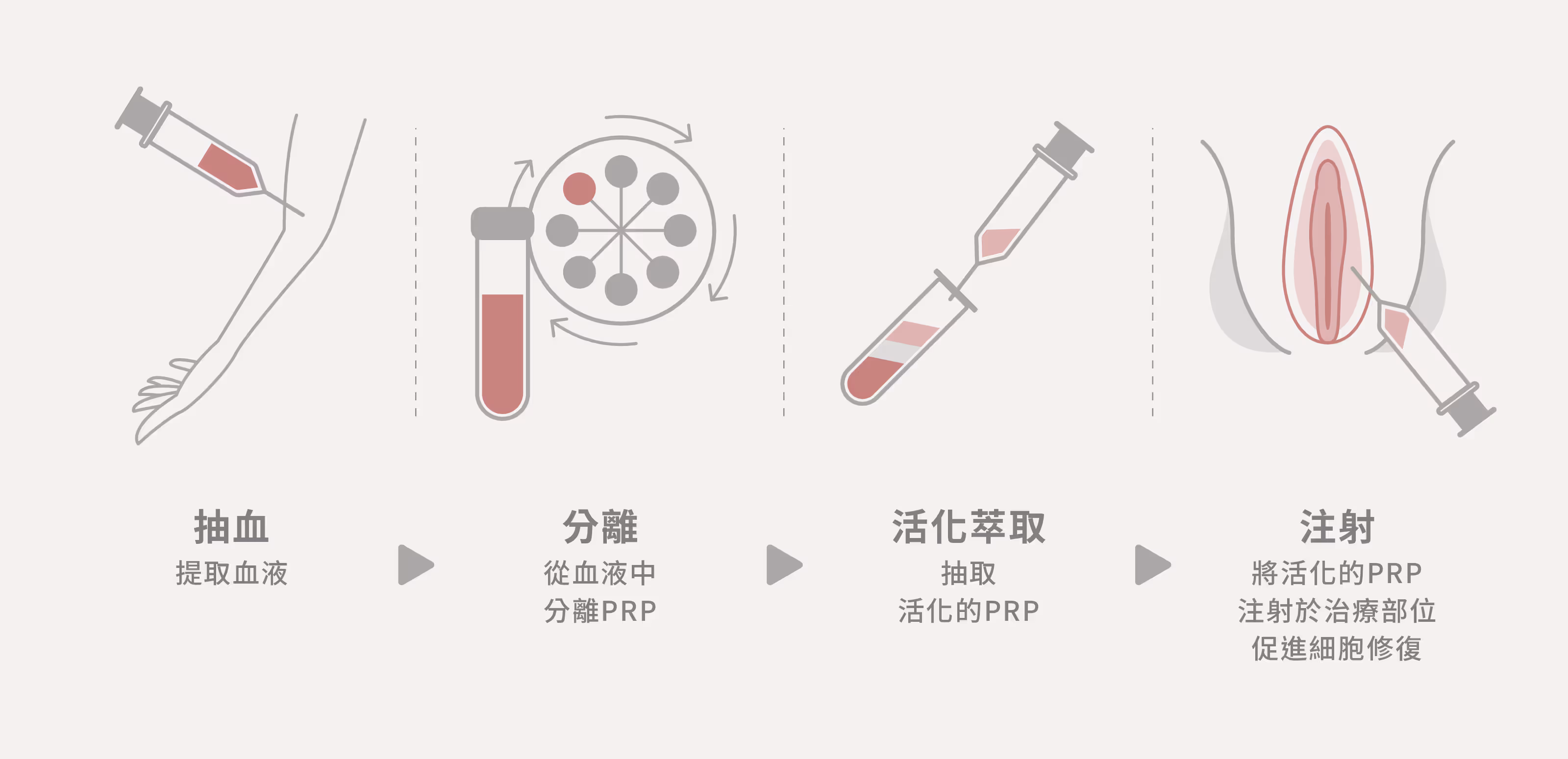 小陰唇介紹