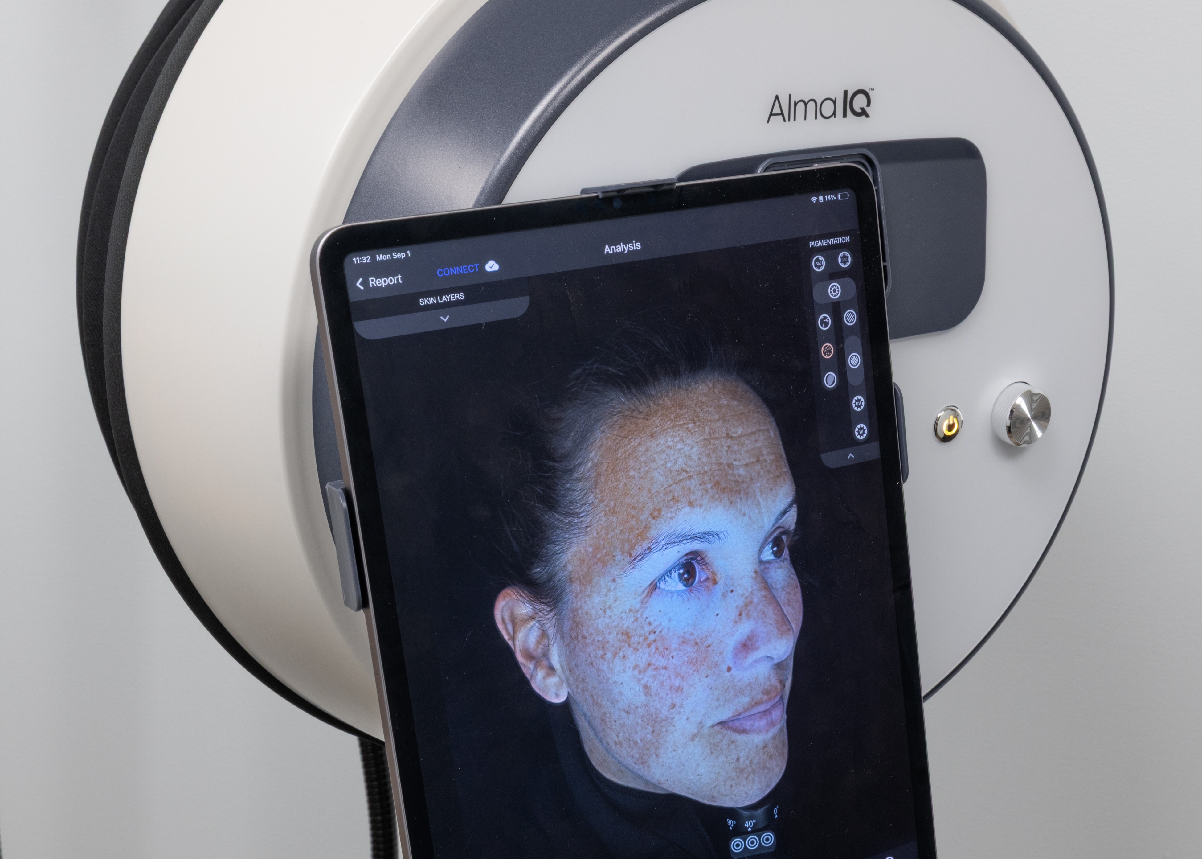 Alma IQ