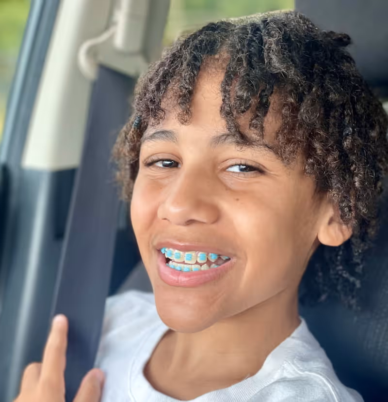 Color Braces: See Why Kids Love Their Fun Colorful Smiles