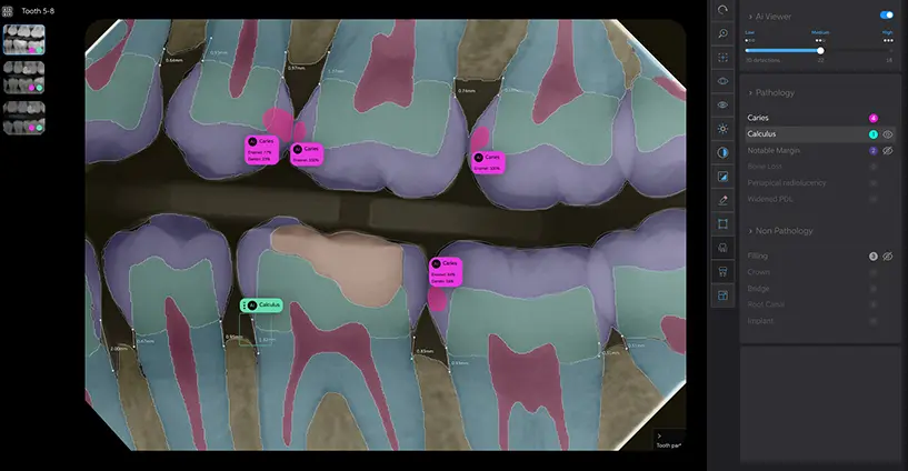Pearl AI in Alexandria, VA | Dental Inc.