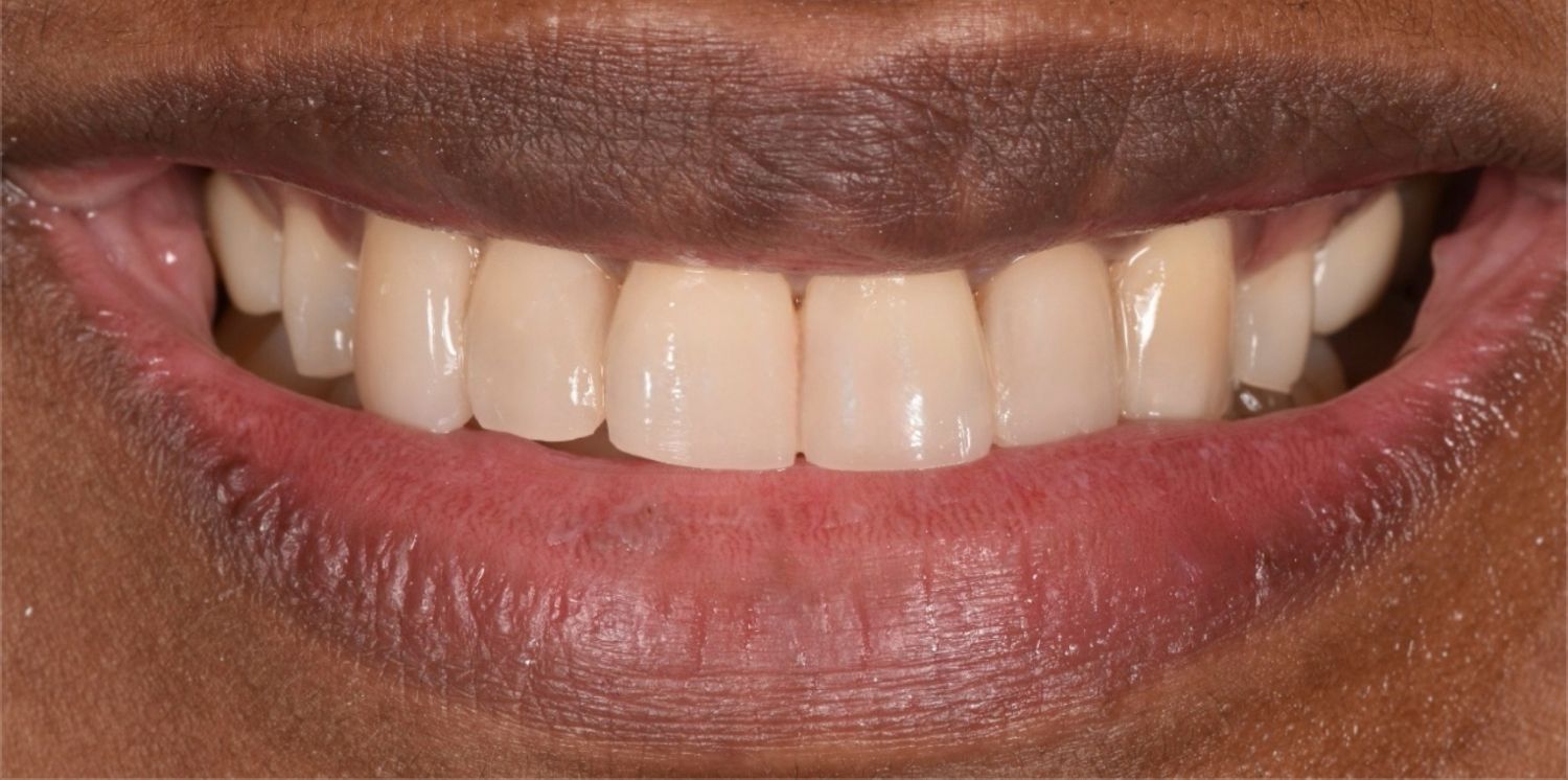 After Image