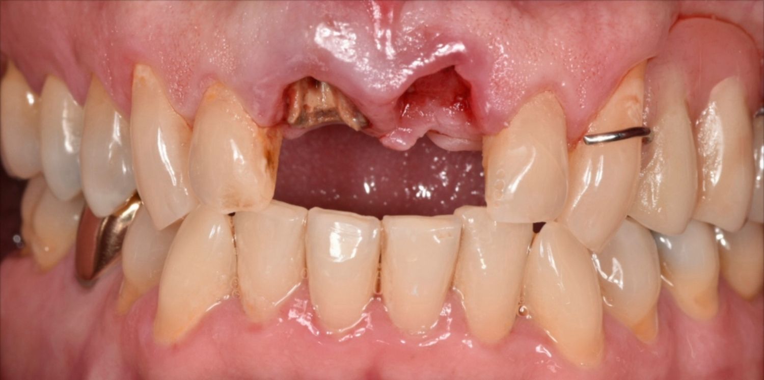Before Image