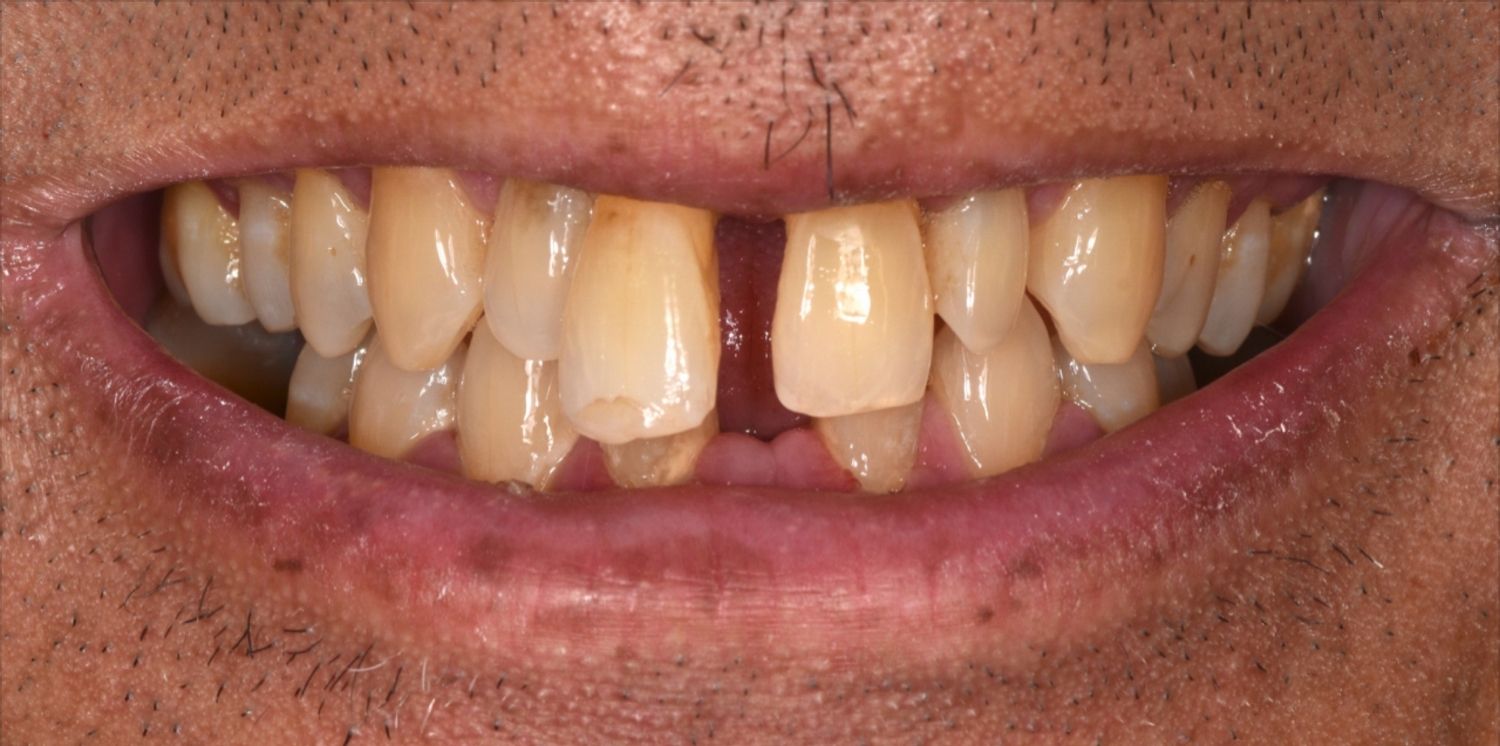 Before Image