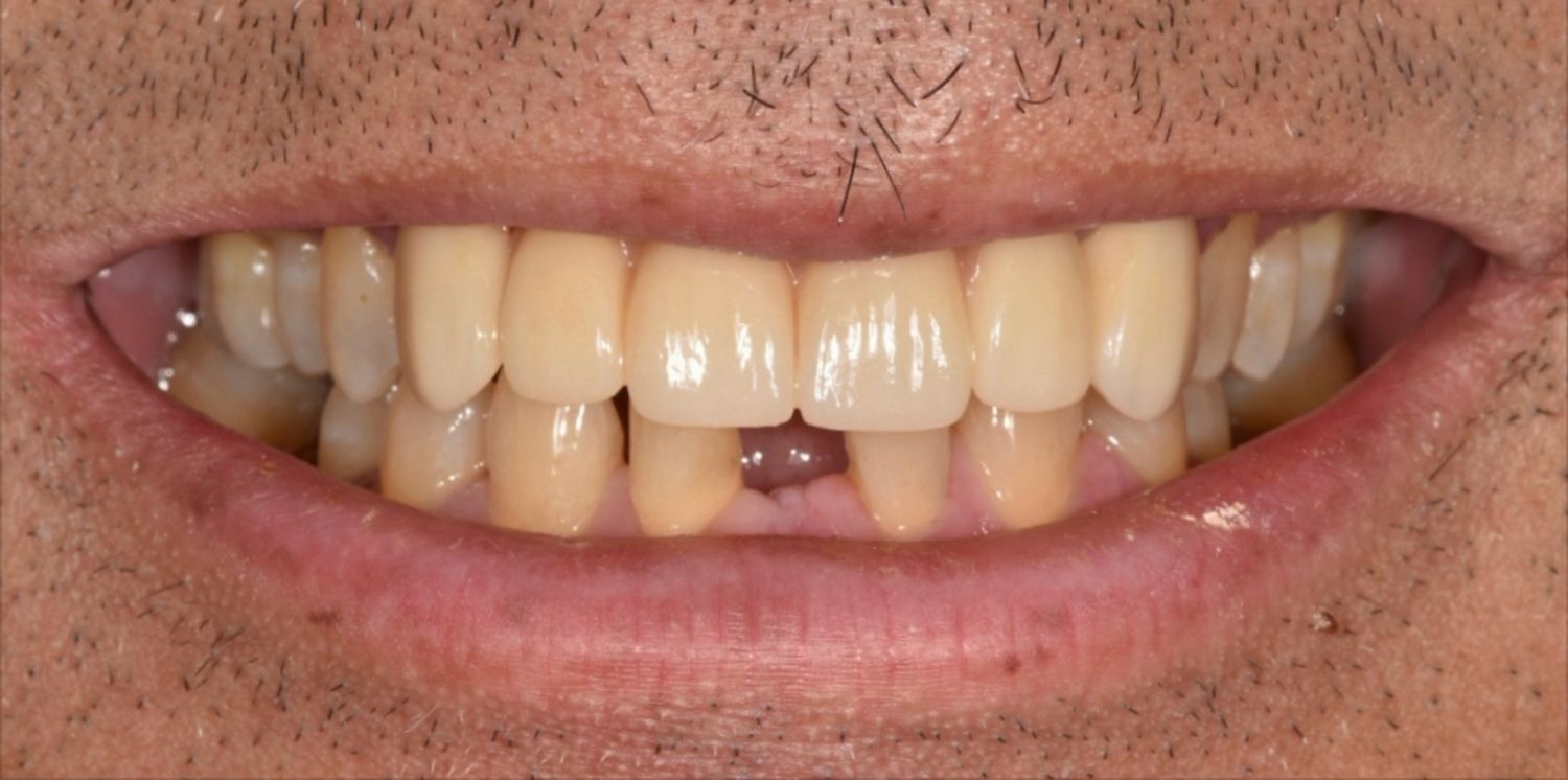 After Image