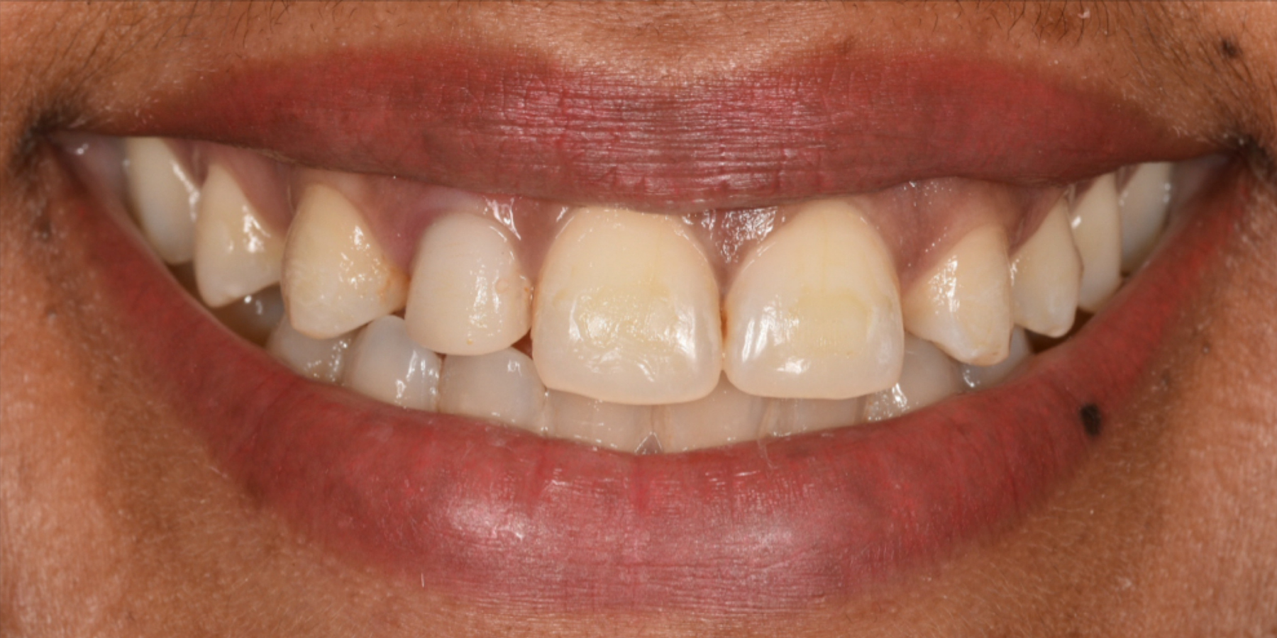 Before Image