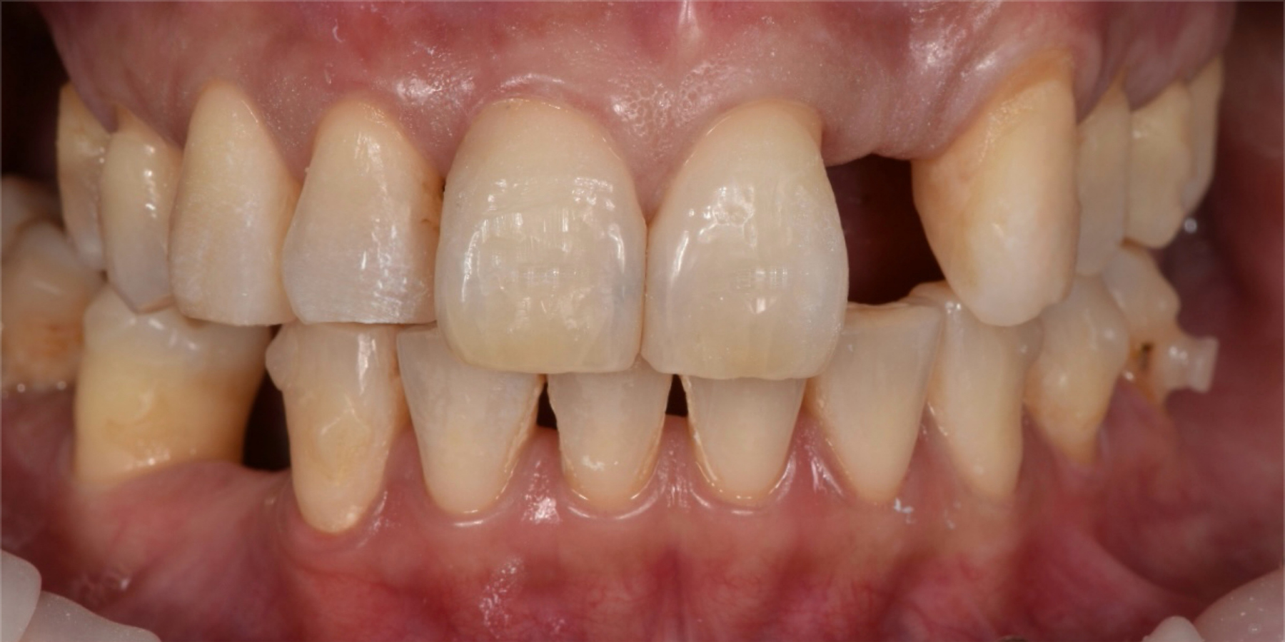Before Image