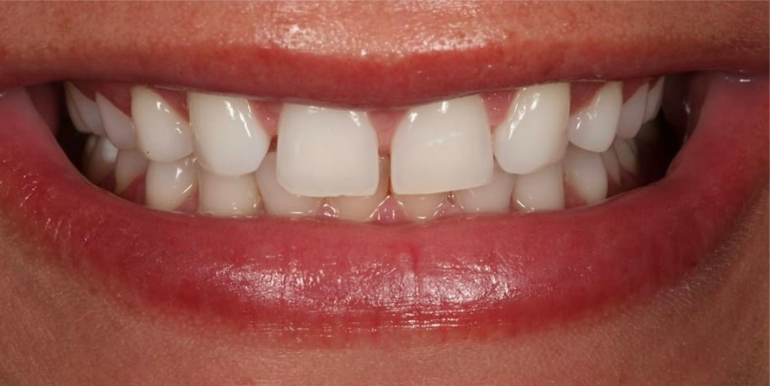Before Image